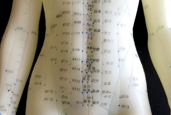 acupunctura Ginecologica